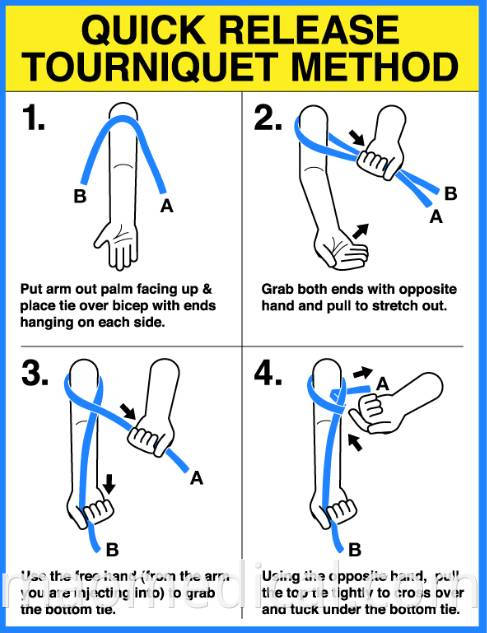 Quick Release Tourniquet Method